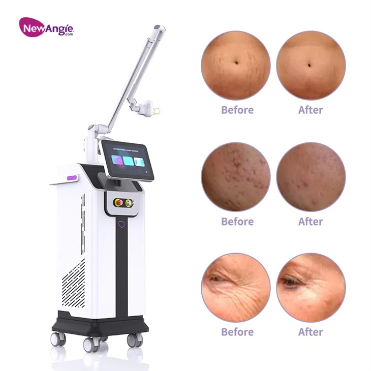 Co2 Resurfacing Laser Machine